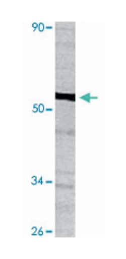 TP53 Rabbit anti-Human, Polyclonal Antibody, Abnova 100 &mu;L | Buy Online | Abnova Corporation | Fisher Scientific
