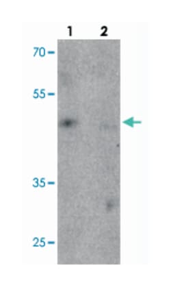 TNFAIP2, Rabbit, Polyclonal Antibody, Abnova 100 &mu;g | Buy Online | Abnova Corporation | Fisher Scientific