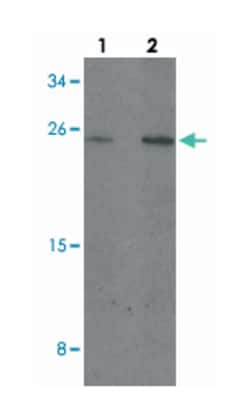 MYCT1, Rabbit, Polyclonal Antibody, Abnova 100&mu;g; Unlabeled:Antibodies,