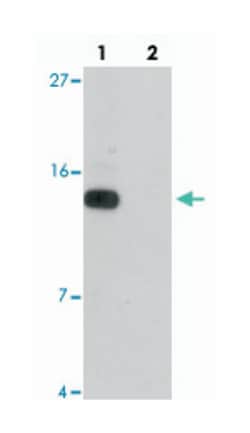 DDA1 Rabbit anti-Human, Mouse, Rat, Polyclonal Antibody, Abnova 100&mu;g;
