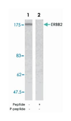 ERBB2 Rabbit anti-Human, Polyclonal Antibody, Abnova 100 &mu;g | Buy Online | Abnova Corporation | Fisher Scientific
