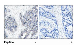 STMN1 Rabbit anti-Human, Mouse, Rat, Polyclonal Antibody, Abnova 100 &mu;g | Buy Online | Abnova Corporation | Fisher Scientific