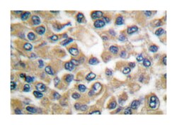 MMP19 Rabbit anti-Human, Mouse, Polyclonal Antibody, Abnova 100&mu;L; Unlabeled:Antibodies,