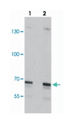 SLC27A6, Rabbit, Polyclonal Antibody, Abnova 100&mu;g; Unlabeled:Antibodies,