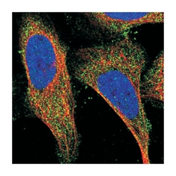 HIGD2BP, Rabbit, Polyclonal Antibody, Abnova 100 &mu;L | Buy Online | Abnova Corporation | Fisher Scientific