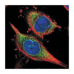 C1orf173, Rabbit, Polyclonal Antibody, Abnova 100 &mu;L | Buy Online | Abnova Corporation | Fisher Scientific