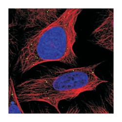 ANKRD2 Rabbit anti-Human, Polyclonal Antibody, Abnova 100 &mu;L | Buy Online | Abnova Corporation | Fisher Scientific