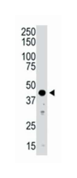 AURKB Rabbit anti-Human, Mouse, Polyclonal Antibody, Abnova 400&mu;L; Unlabeled:Antibodies,