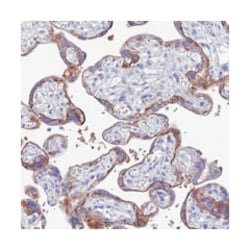 CRB2 Rabbit anti-Human, Polyclonal Antibody, Abnova 100 &mu;L | Buy Online | Abnova Corporation | Fisher Scientific