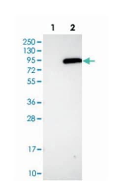 PLA2G6, Rabbit, Polyclonal Antibody, Abnova 100&mu;L; Unlabeled:Antibodies,