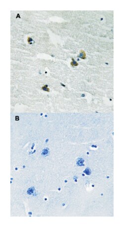 MERTK/TYRO3, Rabbit, Polyclonal Antibody, Abnova 100&mu;L; Unlabeled:Antibodies,