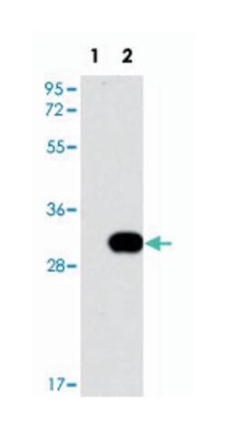 NEK7 Rabbit anti-Human, Polyclonal Antibody, Abnova 400&mu;L; Unlabeled:Antibodies,