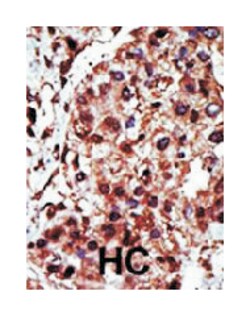 DGKI, Rabbit, Polyclonal Antibody, Abnova 400 &mu;L | Buy Online | Abnova Corporation | Fisher Scientific