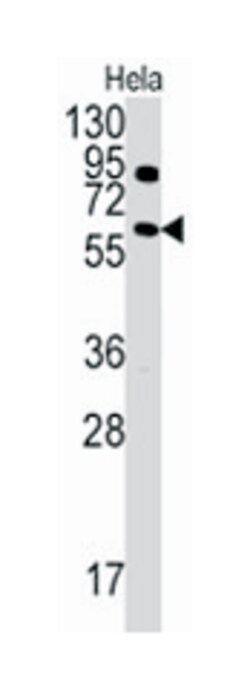 ANTXR1 Rabbit anti-Human, Polyclonal Antibody, Abnova 400&mu;L; Unlabeled:Antibodies,