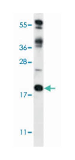 RCAN2 Rabbit anti-Human, Mouse, Polyclonal Antibody, Abnova 400 &mu;L | Buy Online | Abnova Corporation | Fisher Scientific