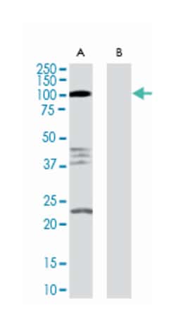 RTN4R, Goat, Polyclonal Antibody, Abnova 100&mu;g; Unlabeled:Antibodies,