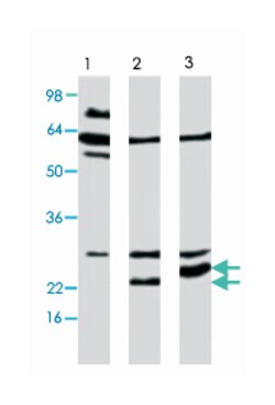 APH1A Rabbit anti-Human, Polyclonal Antibody, Abnova 25&mu;g; Unlabeled:Antibodies,
