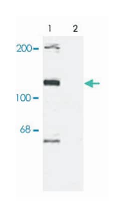 Taok2, Rabbit, Polyclonal Antibody, Abnova 100 &mu;L | Buy Online | Abnova Corporation | Fisher Scientific