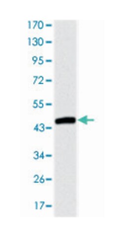 TNNI2, Mouse, Clone: 2F12A11, Abnova 100&mu;L; Unlabeled:Antibodies, Monoclonal