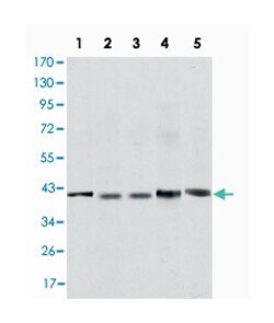 REL, Mouse, Clone: 1E7, Abnova 100&mu;L; Unlabeled:Antibodies, Monoclonal