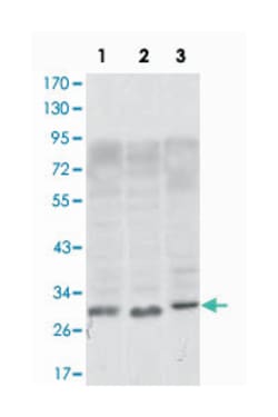 CD69, Mouse, Clone: 8B6, Abnova 100 &mu;L | Buy Online | Abnova | Fisher Scientific