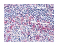 CD69, Mouse, Clone: 8B6, Abnova 100 &mu;L | Buy Online | Abnova | Fisher Scientific