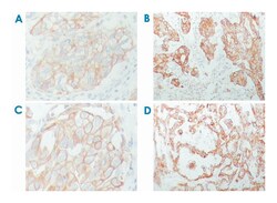 KRT8, Mouse, Clone: 8A5D12, Abnova 100 &mu;L | Buy Online | Abnova | Fisher Scientific