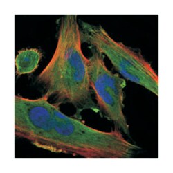 DLK1, Mouse, Clone: 3A10, Abnova 100 &mu;L | Buy Online | Abnova Corporation | Fisher Scientific