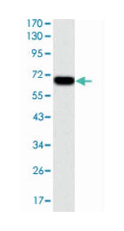 G6PD, Mouse, Clone: 5E12, Abnova 100&mu;L; Unlabeled:Antibodies, Monoclonal