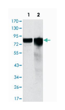GYS1, Mouse, Clone: 3A7, Abnova 100&mu;L; Unlabeled:Antibodies, Monoclonal