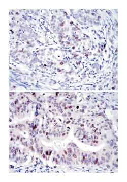 KIF22, Mouse, Clone: 5F3, Abnova 100&mu;L; Unlabeled:Antibodies, Monoclonal