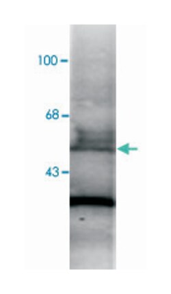 RARA, Mouse, Clone: 763, Abnova 100&mu;L; Unlabeled:Antibodies, Monoclonal