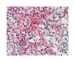 CCL5, Mouse, Clone: 8.PP.11, Abnova 50&mu;g; Unlabeled:Anticuerpos