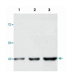ERK1, Mouse, Clone: E19, Abnova 100 &mu;g | Buy Online | Abnova Corporation | Fisher Scientific