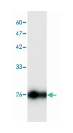 BCL2, Mouse, Clone: 7, Abnova 100&mu;g; Unlabeled:Antibodies, Monoclonal