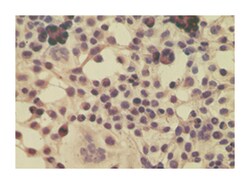 IPO8, Rabbit, Polyclonal Antibody, Abnova 100&mu;g; Unlabeled:Antibodies,