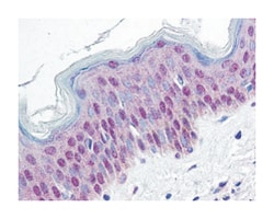 HMGN1, Rabbit, Polyclonal Antibody, Abnova 100 &mu;g | Buy Online | Abnova Corporation | Fisher Scientific