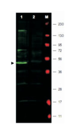 FBXO5, Rabbit, Polyclonal Antibody, Abnova 100 &mu;g | Buy Online | Abnova | Fisher Scientific