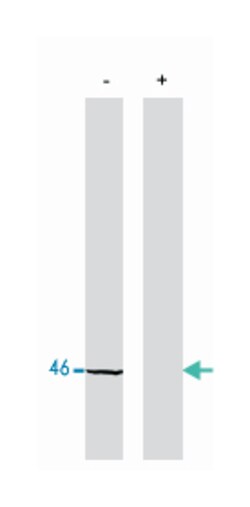 Protein Phosphatase 2 C alpha/beta, Rabbit, Polyclonal Antibody, Abnova