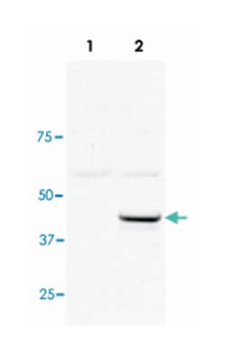 UBE2J1, Rabbit, Polyclonal Antibody, Abnova 100&mu;g; Unlabeled:Antibodies,