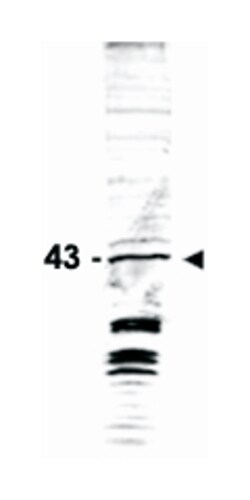 SWI6 Rabbit anti-S. pombe, Polyclonal Antibody, Abnova 100 &mu;g | Buy Online | Abnova Corporation | Fisher Scientific