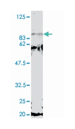 SRB4, Rabbit, Polyclonal Antibody, Abnova 50 &mu;L | Buy Online | Abnova Corporation | Fisher Scientific
