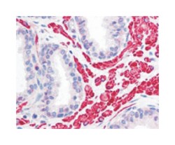 OPA1, Rabbit, Polyclonal Antibody, Abnova 100 &mu;L | Buy Online | Abnova Corporation | Fisher Scientific