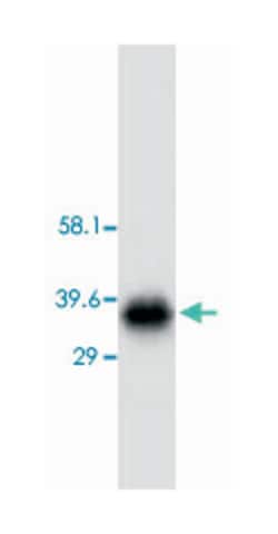 AQP4 Rabbit anti-Human, Mouse, Rat, Polyclonal Antibody, Abnova 100&mu;g;