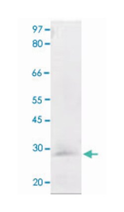 BCL2 (phospho T56), Rabbit anti-Human, Polyclonal Antibody, Abnova 100&mu;g;