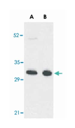 TNFRSF13B Rabbit anti-Human, Polyclonal Antibody, Abnova 100&mu;g; Unlabeled:Antibodies,