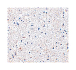 SCO1, Rabbit, Polyclonal Antibody, Abnova 100μg; Unlabeled:Antibodies,