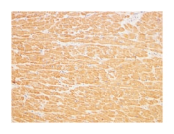 TIRAP Rabbit anti-Human, Mouse, Rat, Polyclonal Antibody, Abnova 100&mu;g;