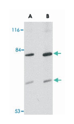 TMC8 Rabbit anti-Human, Mouse, Rat, Polyclonal Antibody, Abnova 100 &mu;g | Buy Online | Abnova | Fisher Scientific