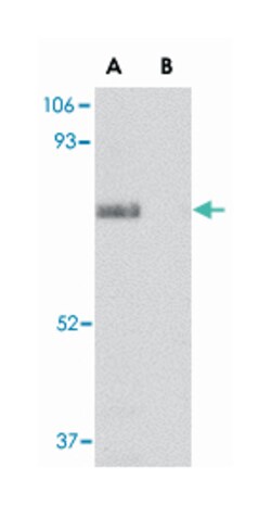 SCARB2 Rabbit anti-Human, Mouse, Rat, Polyclonal Antibody, Abnova 100&mu;g;